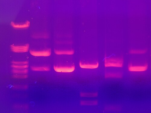 Labfoto van DNA-gel bij gel-electroforese